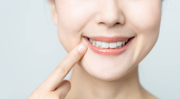 Cold Sore and Canker Treatment
